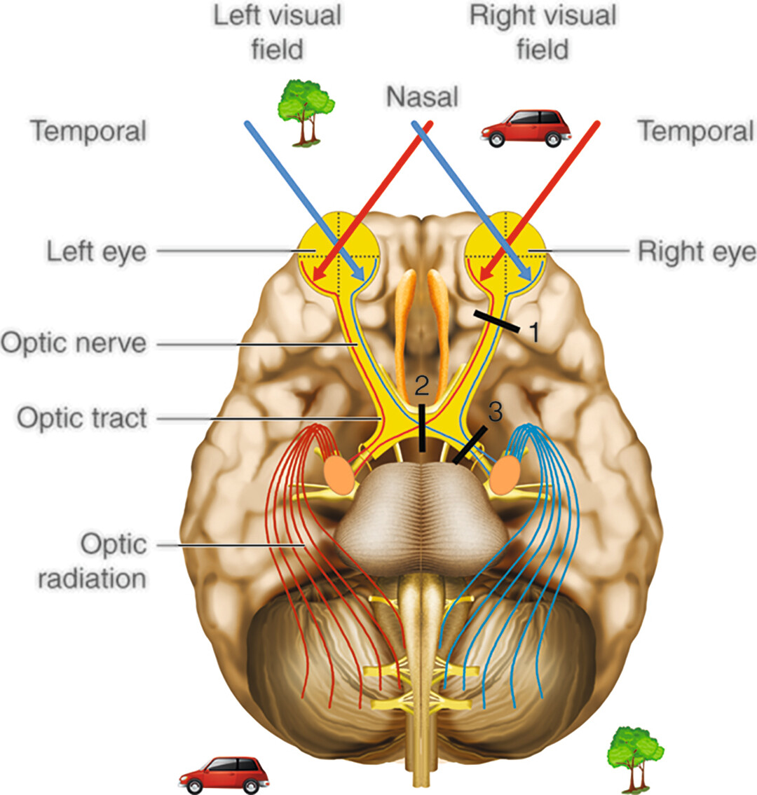 The Eye And Vision Anatomy Worksheet Structure And Functions Of Human