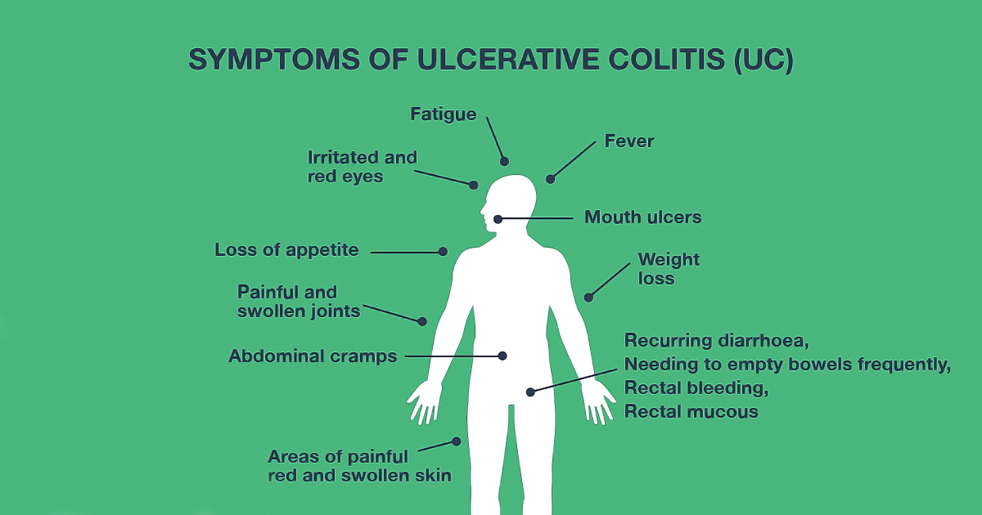 Ulcerative Colitis Pain Location, Frequency, and Other Symptoms
