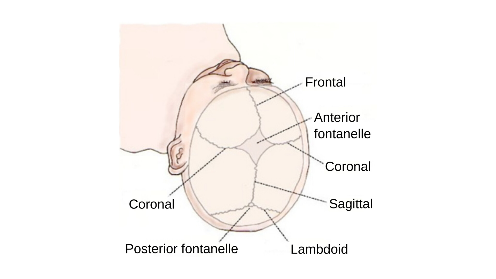 What Is Rubinstein-Taybi Syndrome? - StoryMD