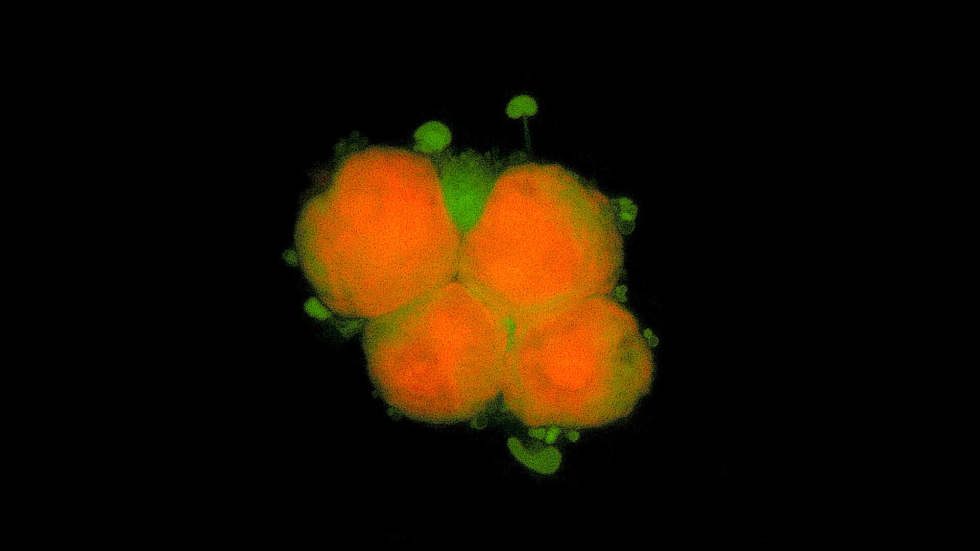 what-are-the-stages-of-chronic-myelogenous-leukemia-storymd