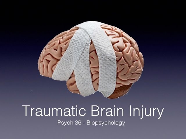 About Traumatic Brain Injury (TBI) - StoryMD