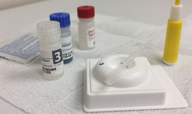 HIV Antibody Tests: Why Is It Done and What the Results Mean - StoryMD