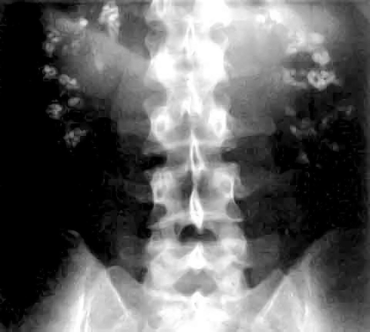 Contorl Sign Rta What Are the Signs and Symptoms of RTA?