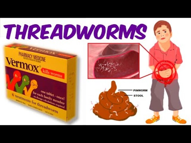 threadworms in stool