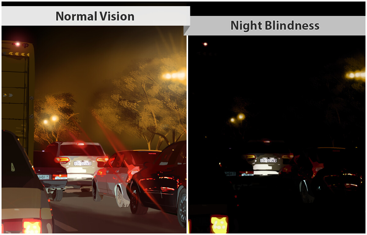 What Causes Night Blindness? 