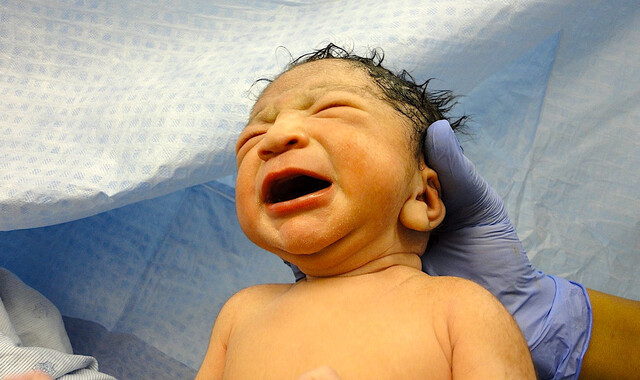 Fetal Transition to Extrauterine Life