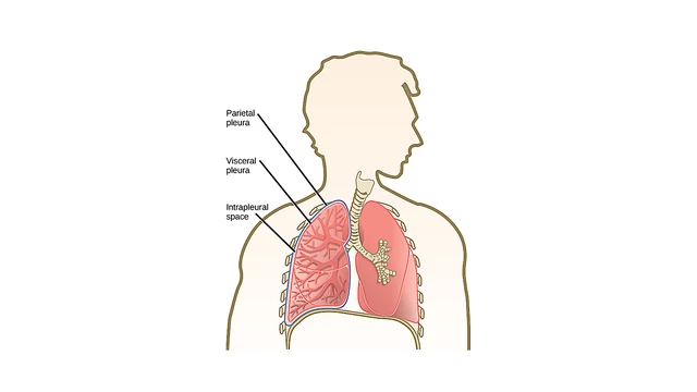 Thoracentesis - StoryMD