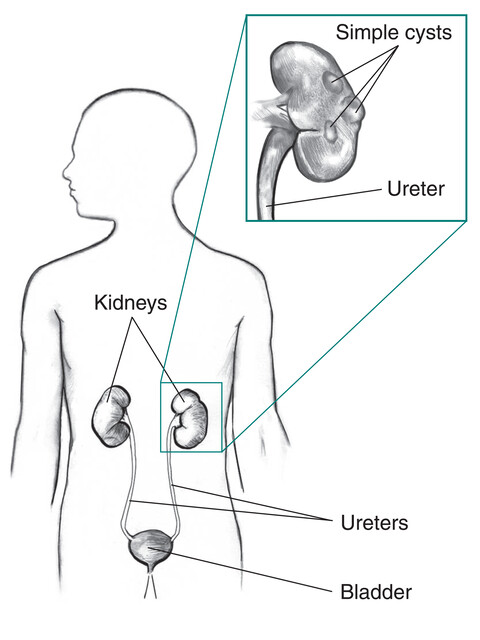 Urinary System Diagram | Quizlet