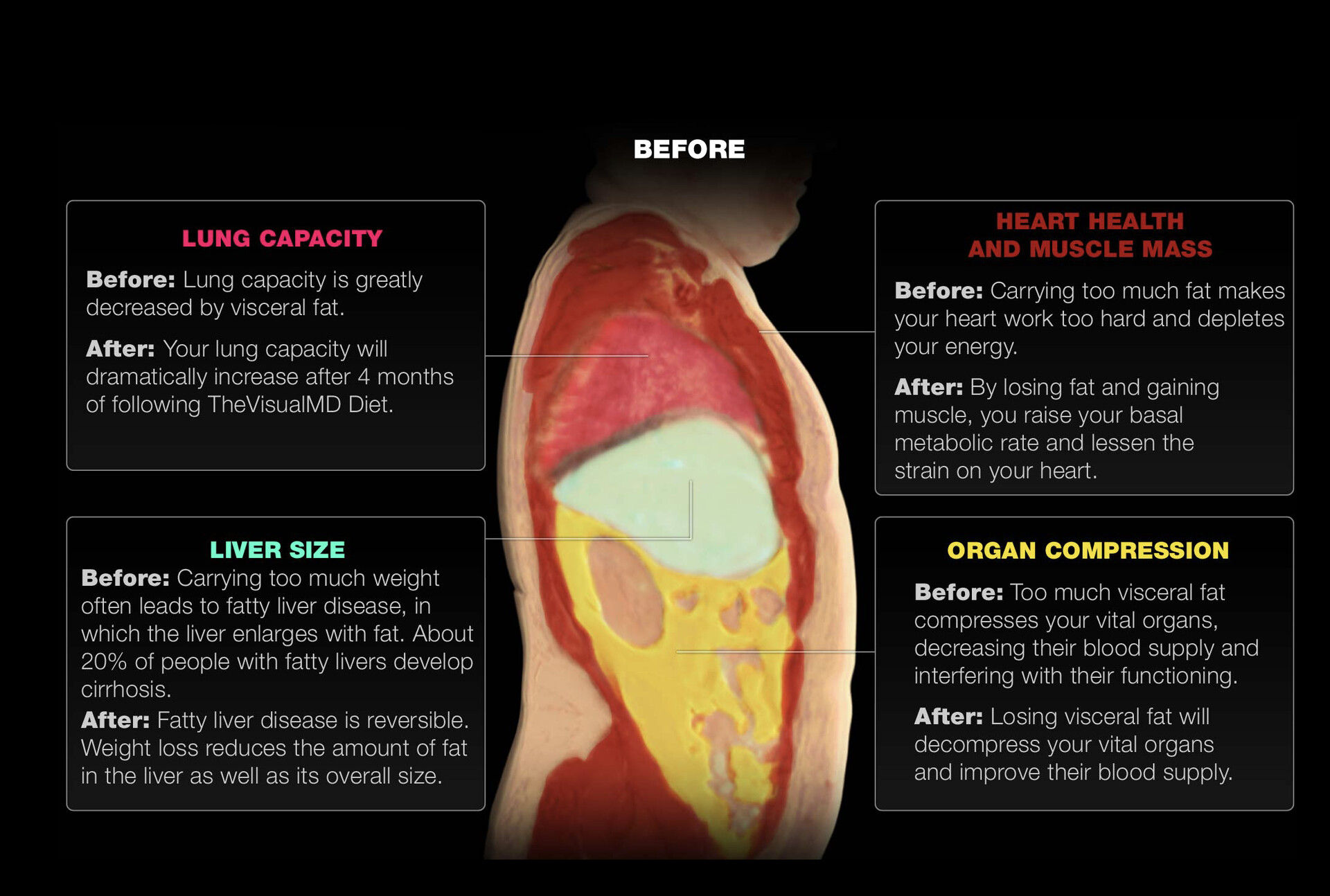 Signs Symptoms And Complications Of Overweight And Obesity StoryMD