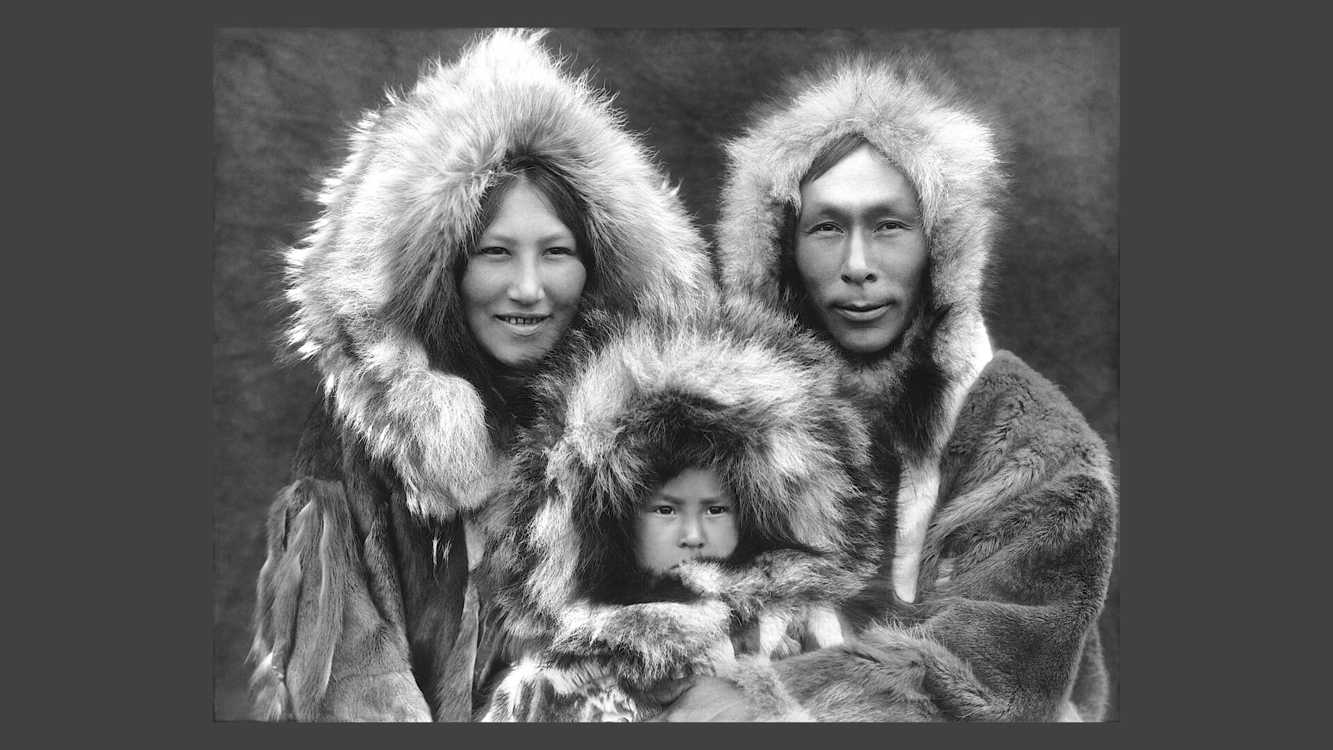 Kuskokwim Syndrome StoryMD