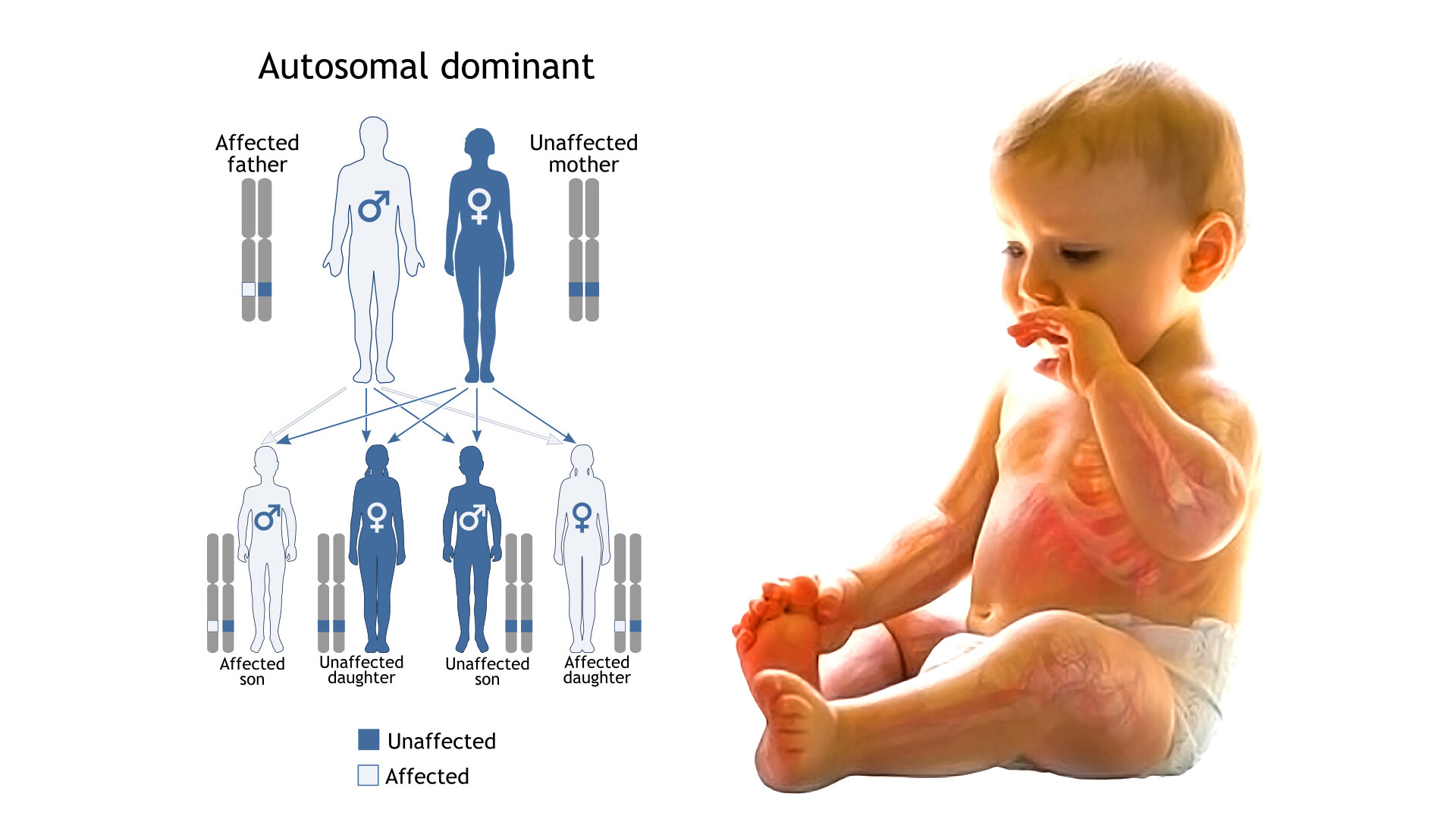 how-is-familial-hypercholesterolemia-inherited-storymd