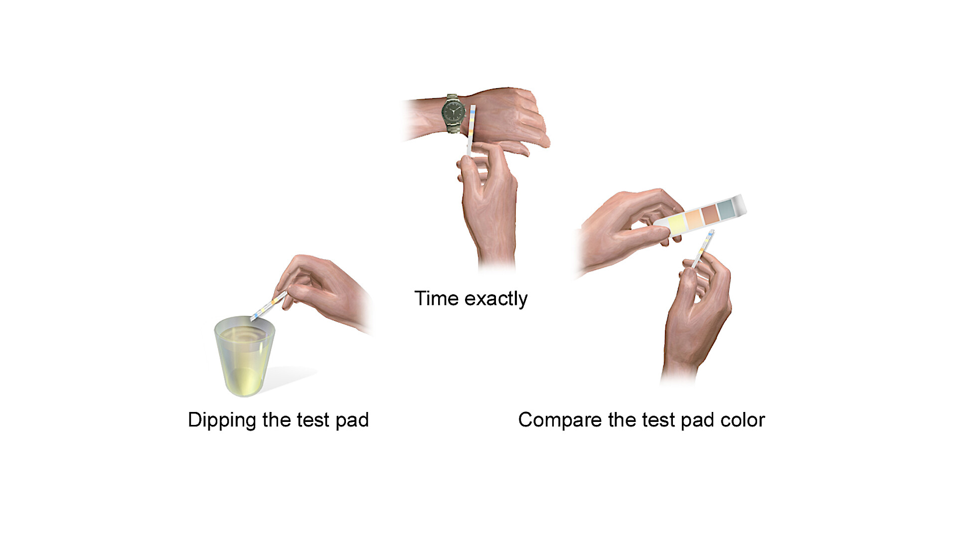Ketones in Urine Test Why Is It Done and What the Results Mean StoryMD