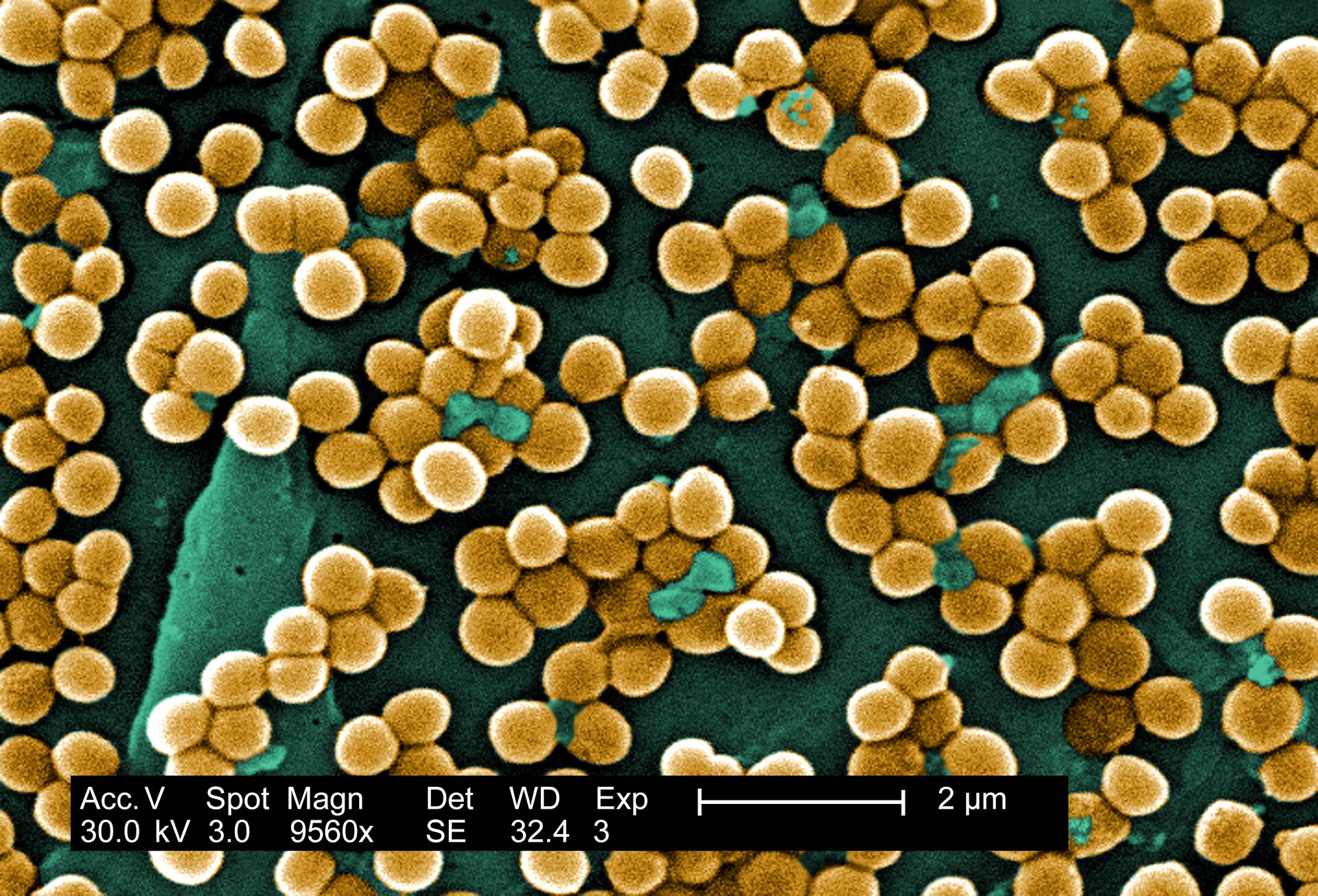 Staphylococcal Infections - StoryMD