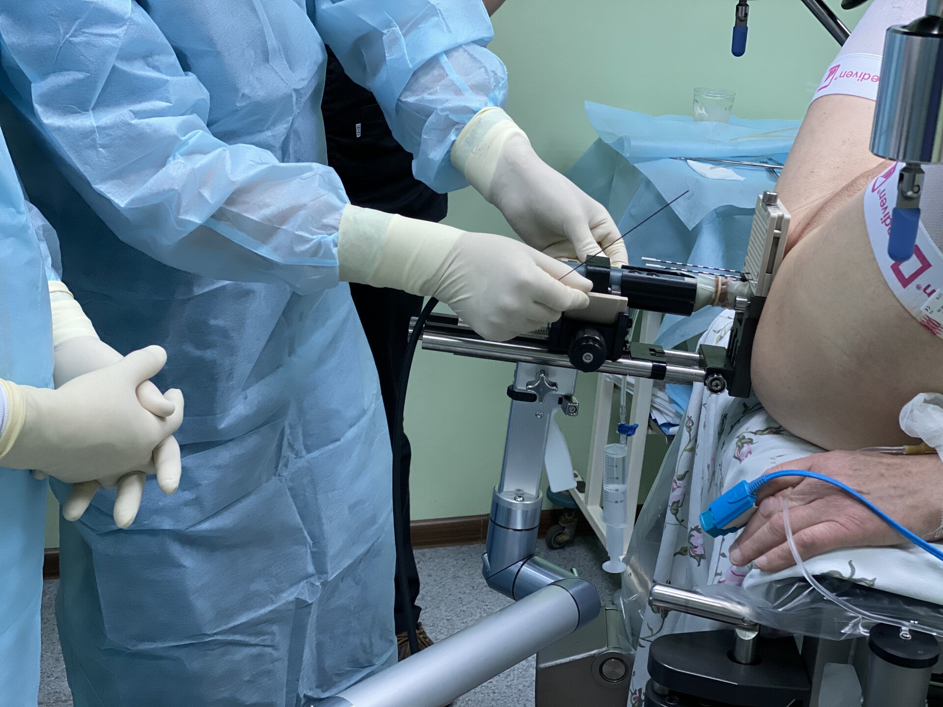 Brachytherapy What to Expect When the Catheter Is Removed StoryMD