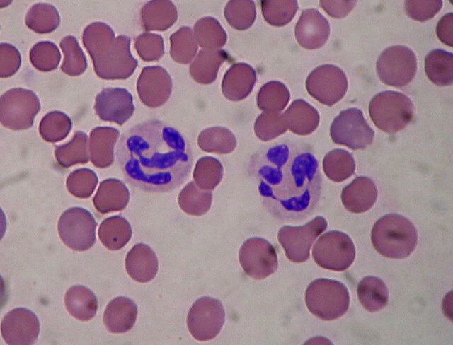 Neutrophils Normal Range Uk