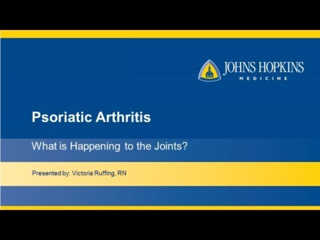 Arthritis  Johns Hopkins Medicine