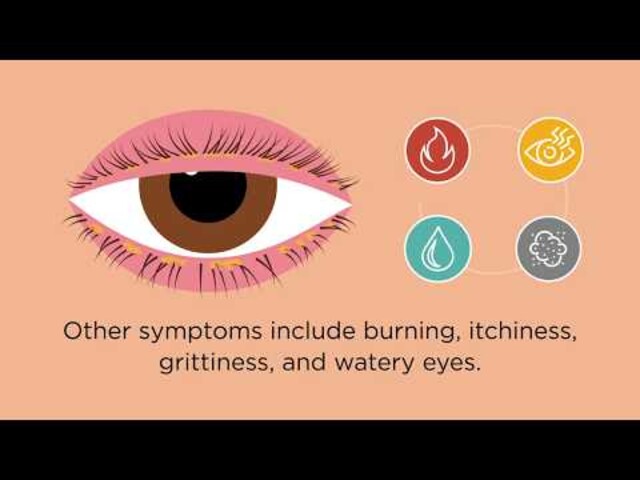 Blepharitis (Eyelid Inflammation): Causes & Treatment