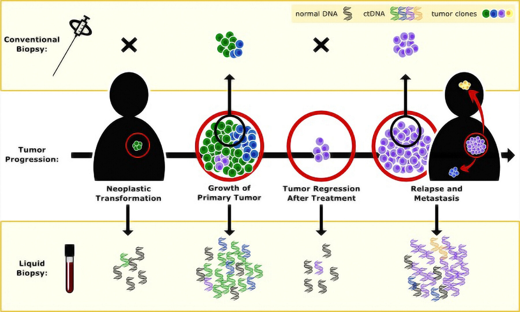 What Is Circulating Tumor DNA And How Is It Used To Diagnose And Manage ...