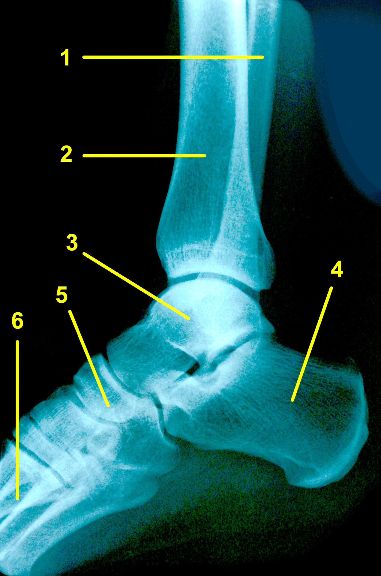 Dorsiflexion and Plantar Flexion of the Foot