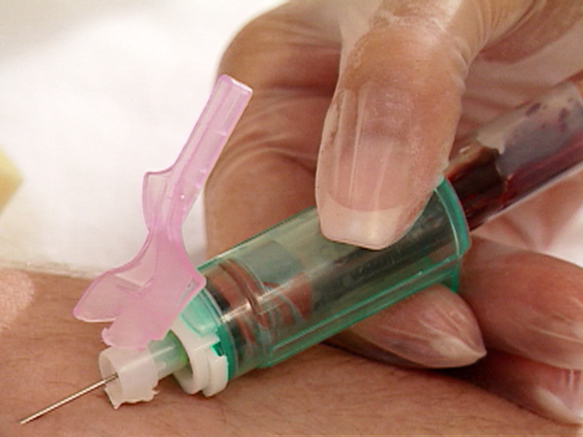 hiv-lab-tests-storymd