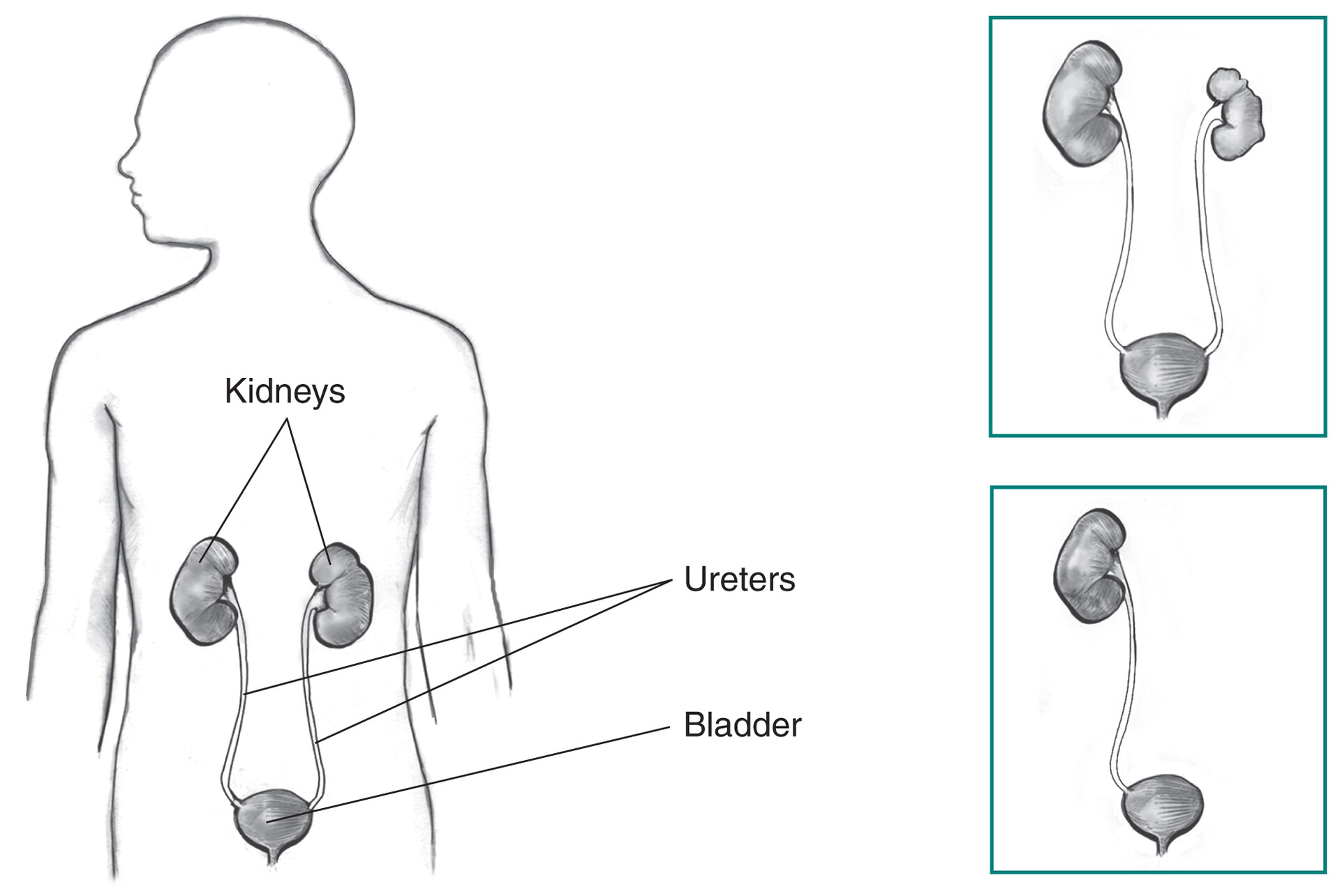 Kidney Sketch Anatomy Outline Vector Illustration Stock Vector (Royalty  Free) 1506155765 | Shutterstock