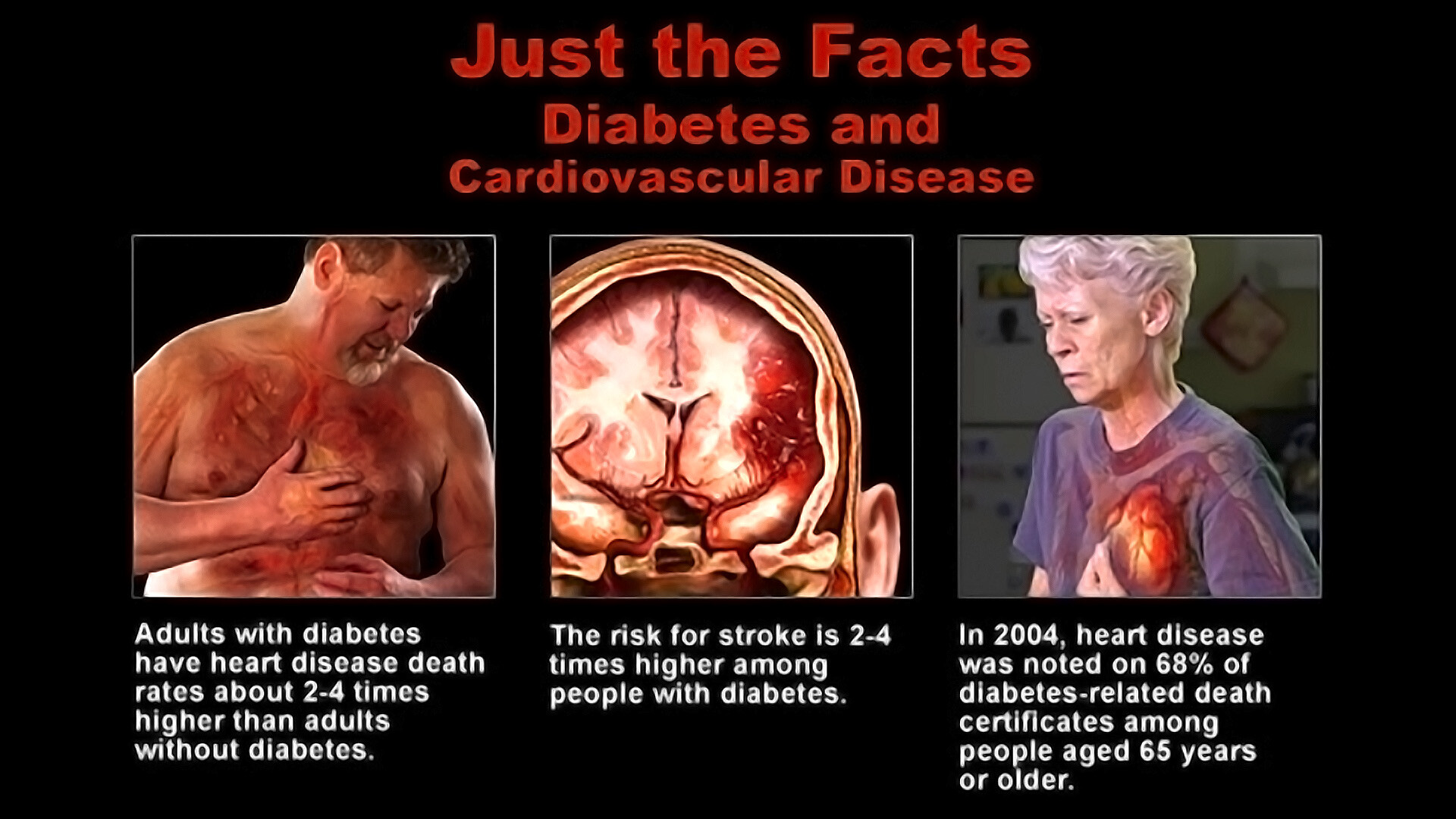 Signs and Symptoms of Diabetic Heart Disease   StoryMD