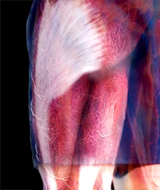 Posterior Thigh Muscles Cadaver Afbeeldingen Over Biceps Femoris