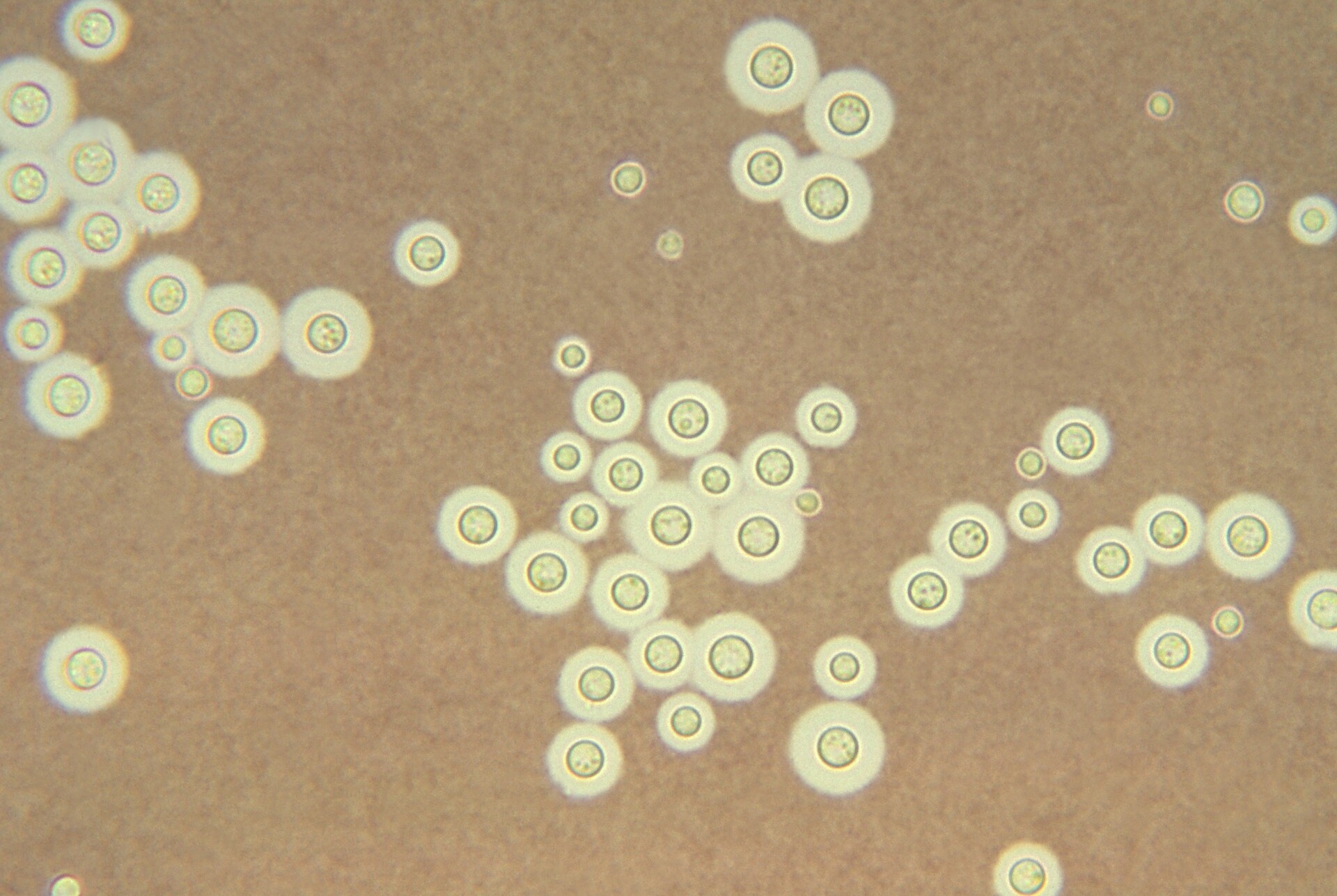 Cryptococcus Brain