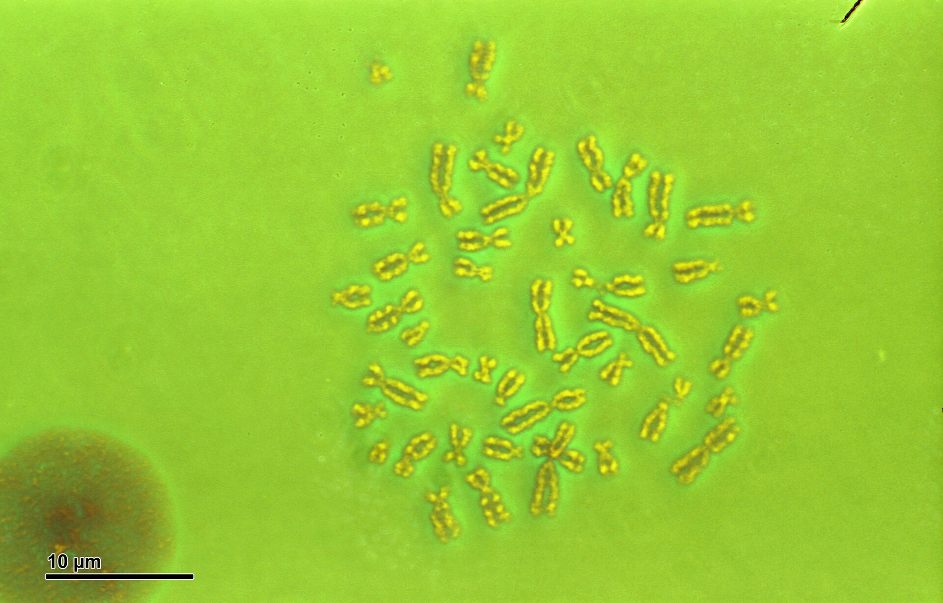 What Kind of Testing Is Necessary to Determine the Underlying Cause of