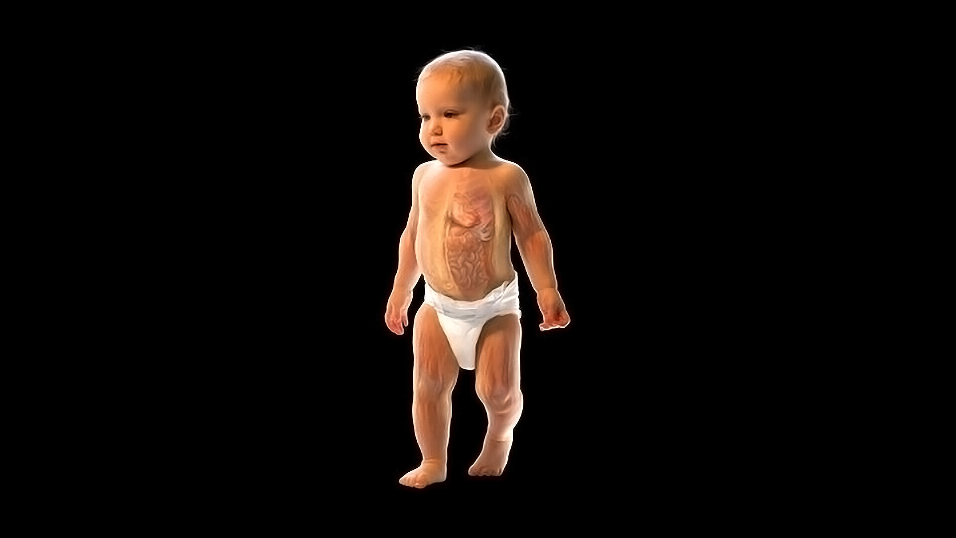 Childhood Colorectal Cancer - StoryMD
