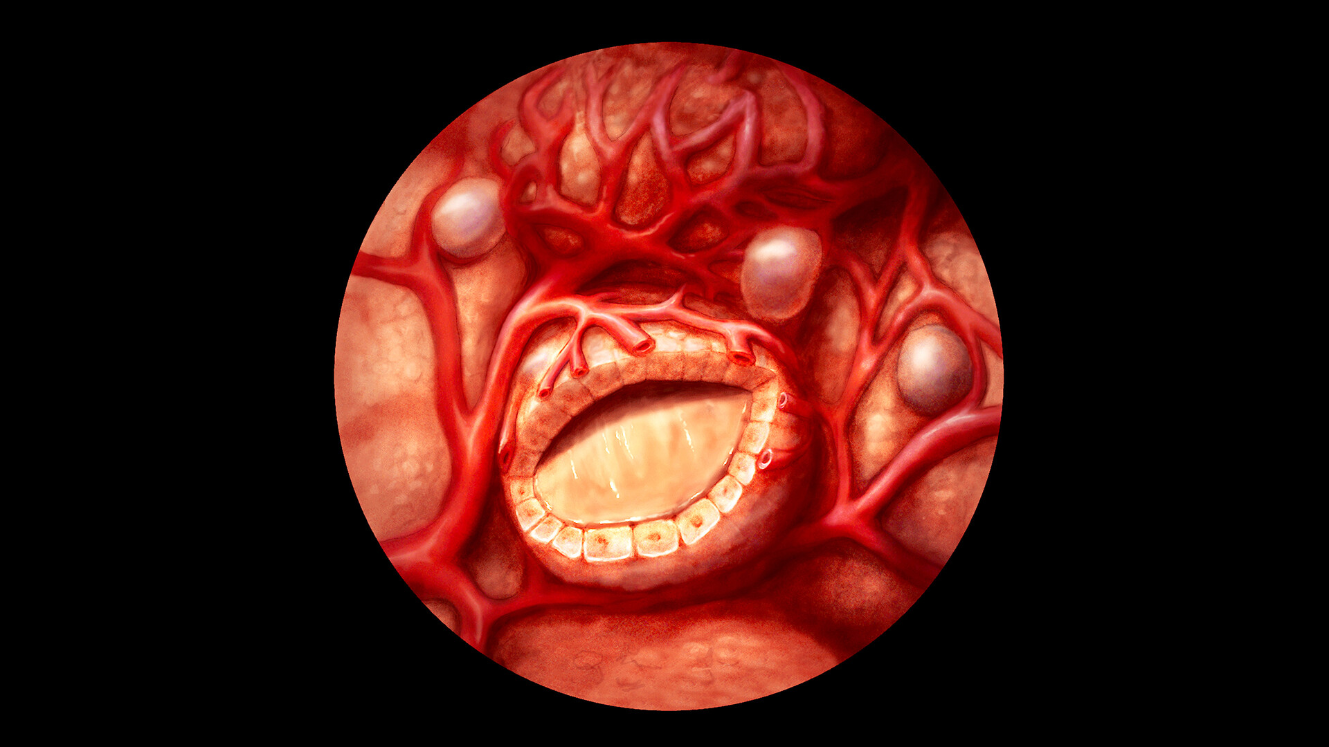 thyroglobulin-antibody-test-why-is-it-done-and-what-the-results-mean