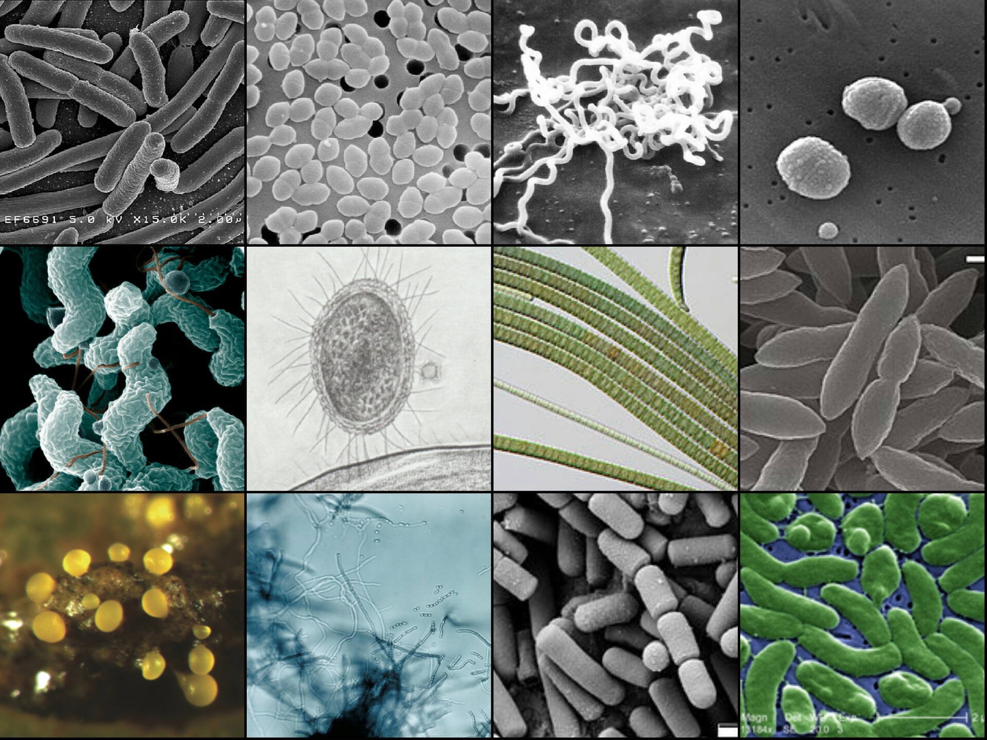 What Are Some Common Foodborne Molds? - StoryMD