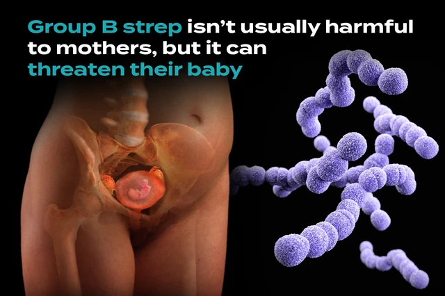 How Can Group B Strep Affect Your Baby? - StoryMD