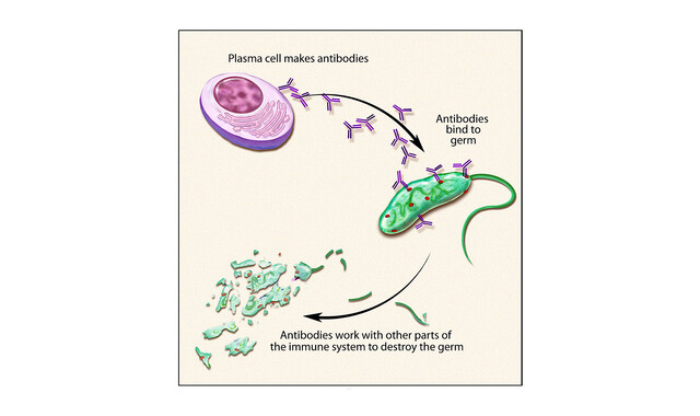 Normal Plasma Cells Plasma Cell Neoplasms (Including Plasma Cell