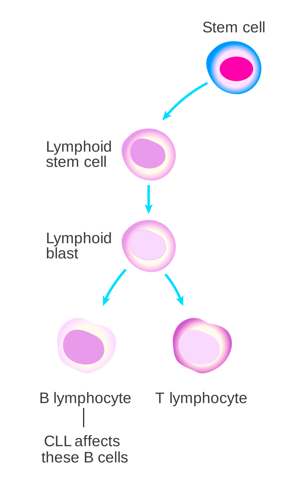 Overview Of Chronic Lymphocytic Leukemia Storymd