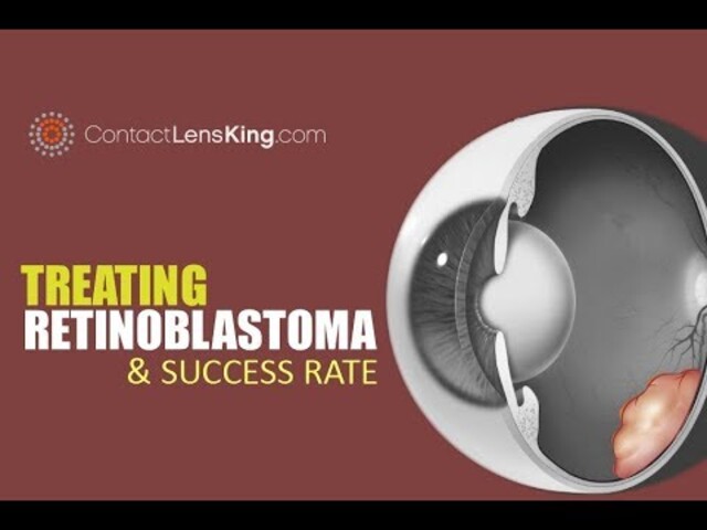 Retinoblastoma Treatment - NCI