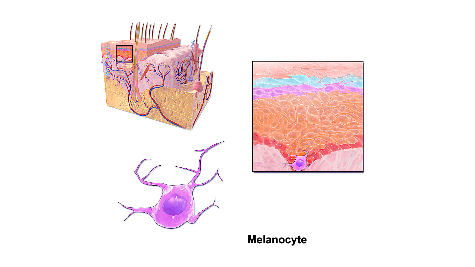Пигмент меланин в каком слое. Меланин в эпидермисе кожи. Меланоциты меланин кожа. Строение эпидермиса меланоциты. Клетки меланоциты эпидермиса кожи.
