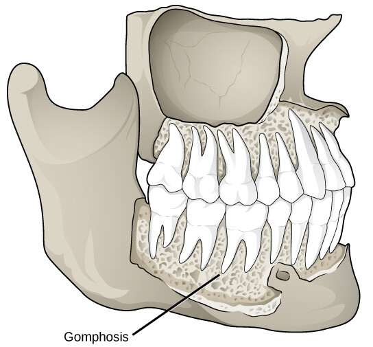 Gomphosis - StoryMD