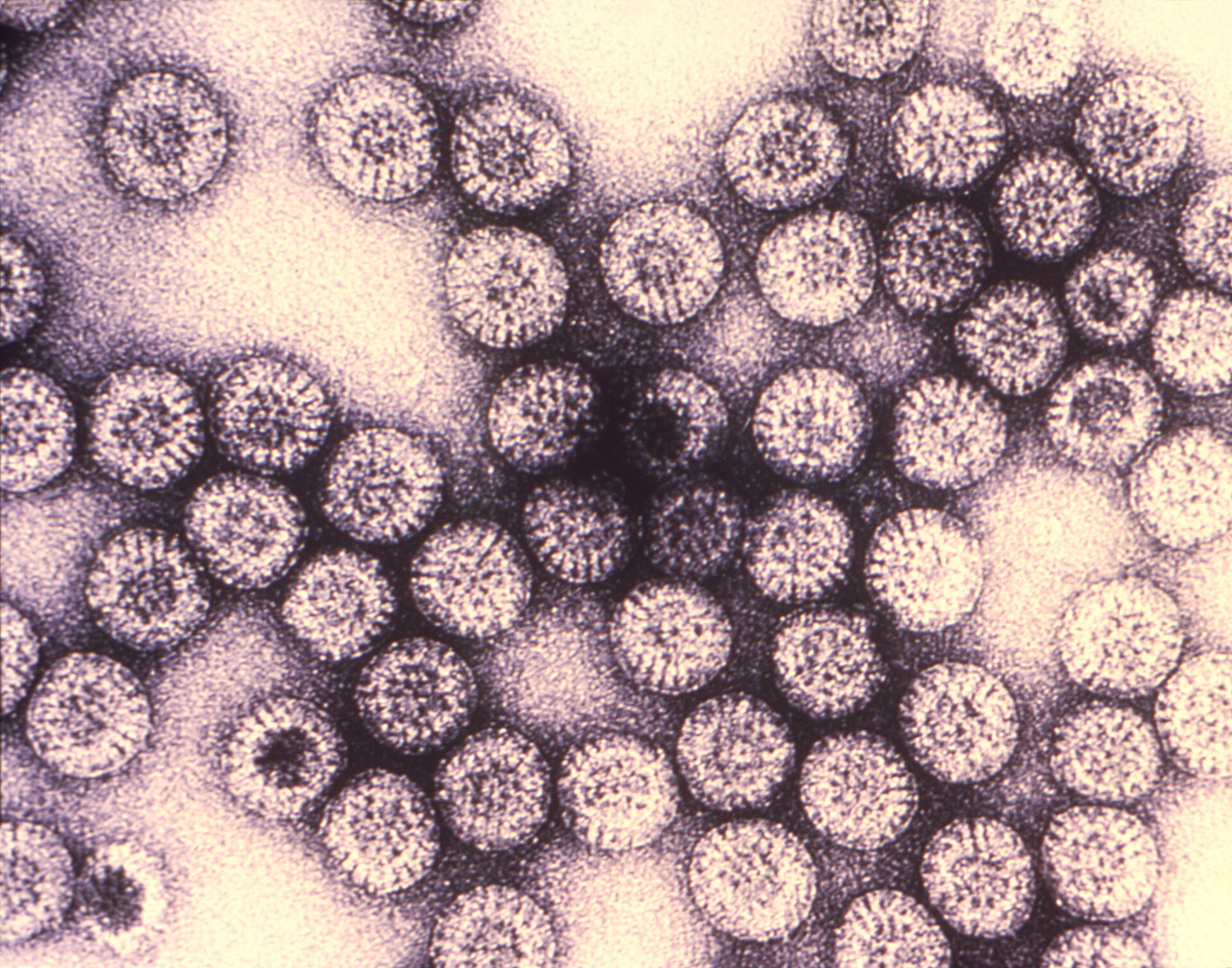 Ротавирусная инфекция вирус