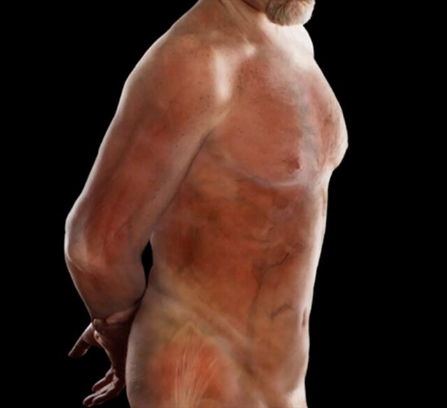 Weight Loss 1) Thin