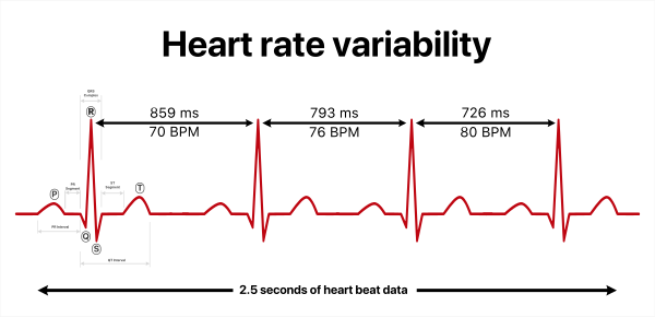 Tachycardia: Fast Heart Rate