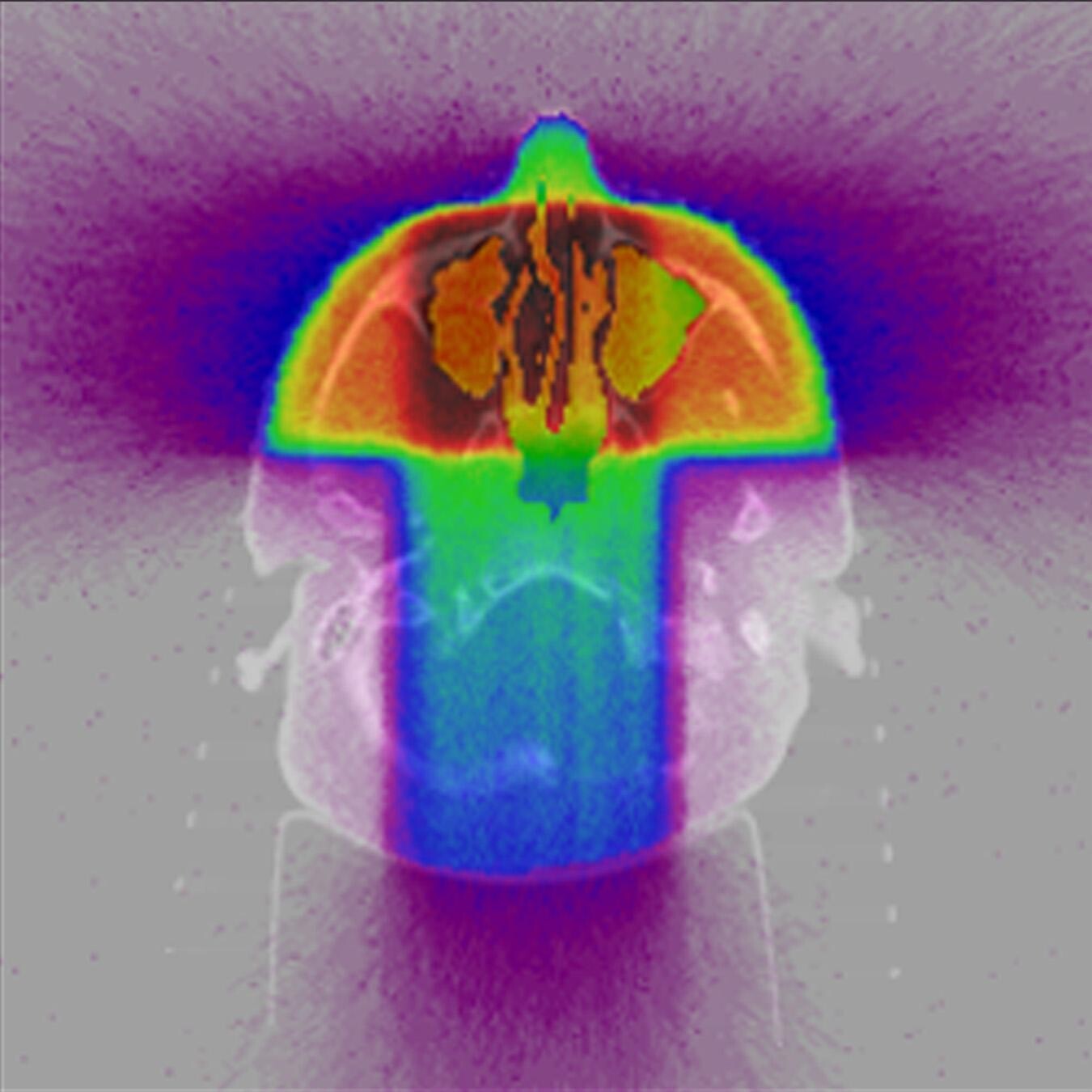 radioisotopes-what-are-they-and-how-are-they-made-storymd