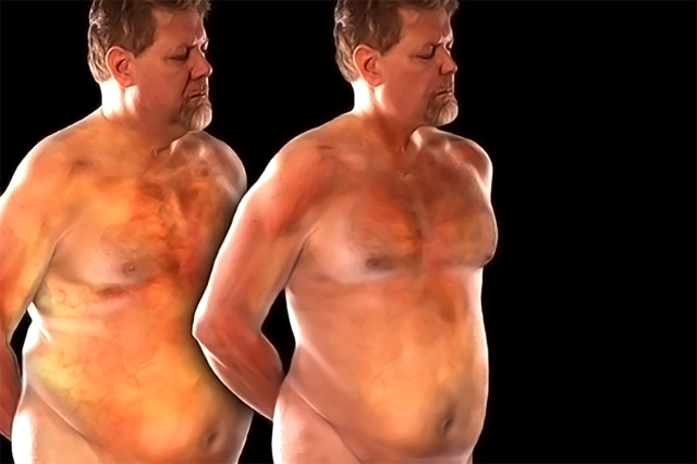 Benefits of Weight Loss