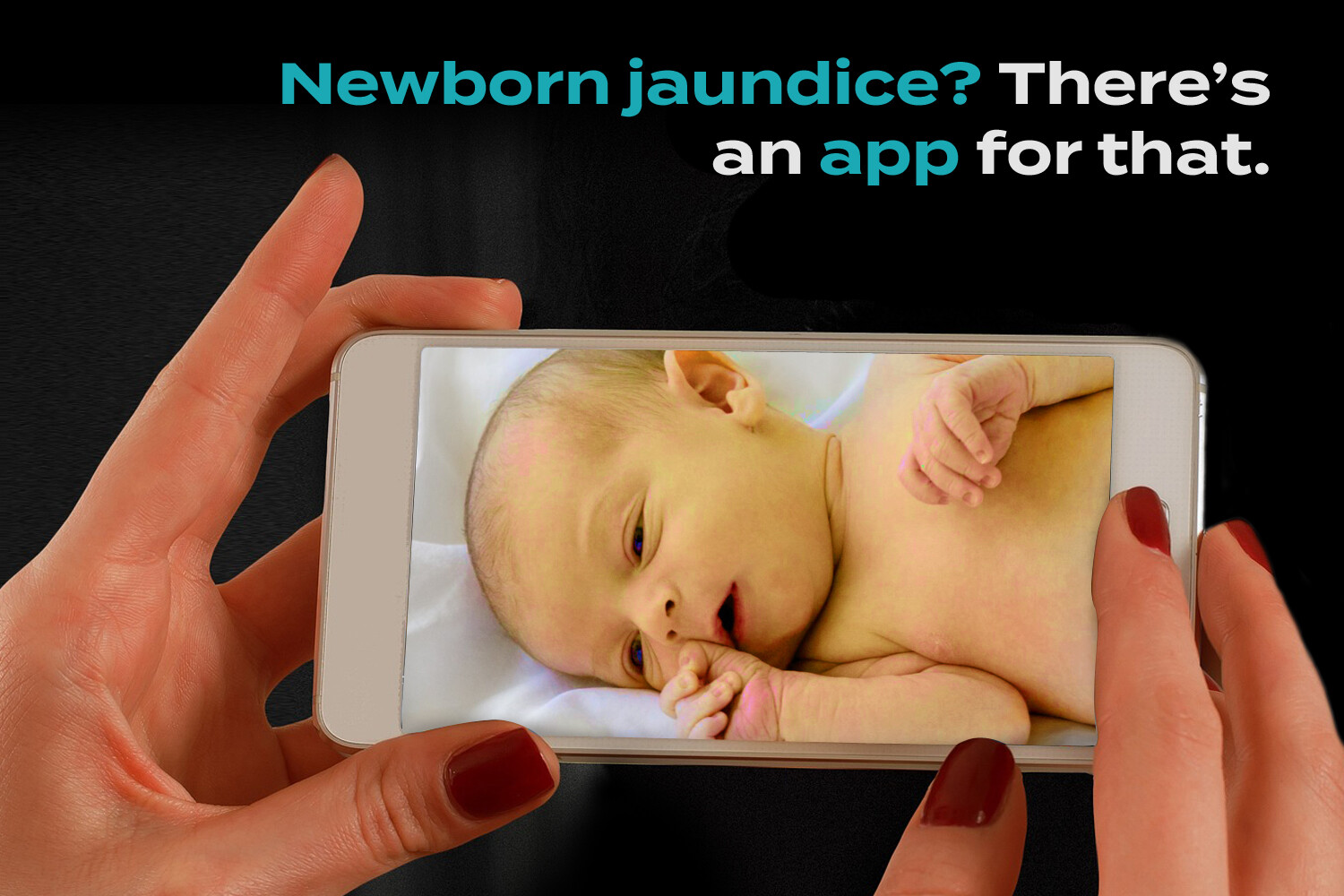 Using A Smartphone App To Detect Neonatal Jaundice StoryMD
