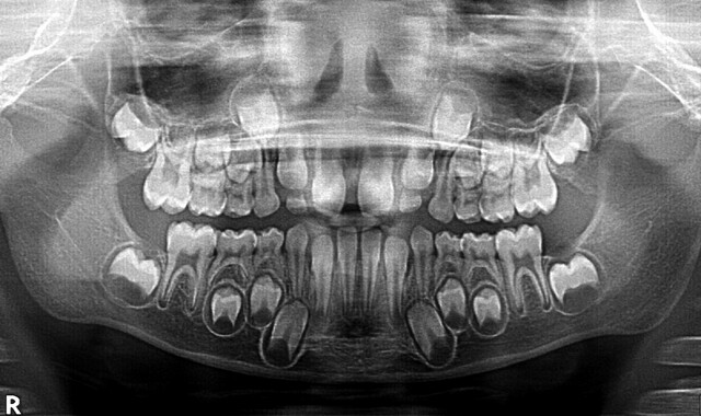 Tooth Disorders - StoryMD