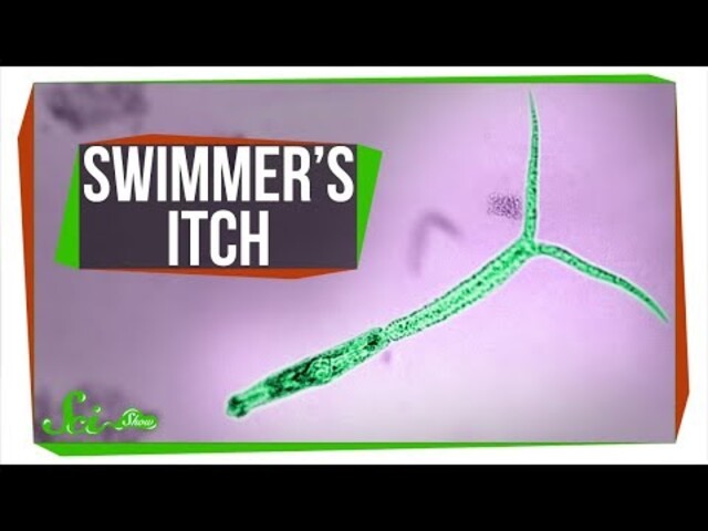WARNING: Doctors give simple steps to avoid swimmer's itch from