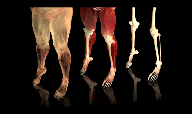 Patellar Tendonitis - StoryMD