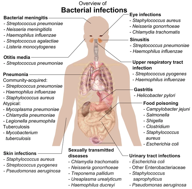 Staphylococcal Infections - StoryMD