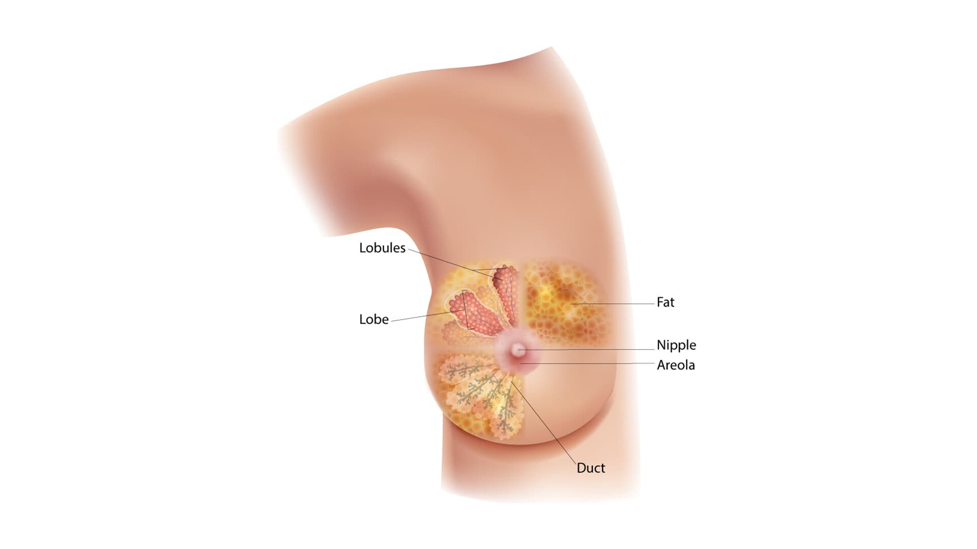 What Are the Symptoms of Breast Cancer? - StoryMD