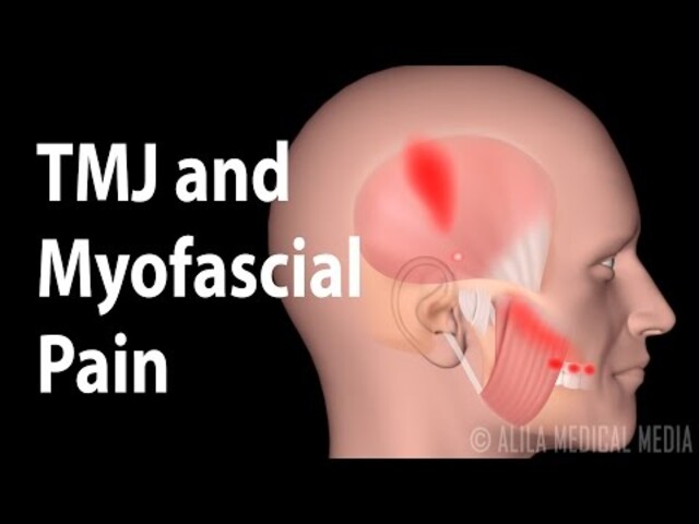 Temporomandibular Joint Dysfunction - StoryMD